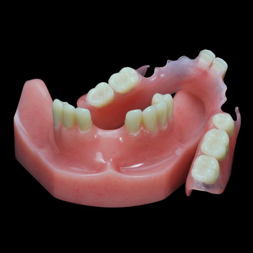 GD-07 Flexible Partial Upper Denture | Paradigm Dental Models