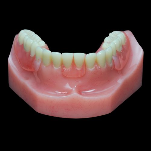 GD-07 Flexible Partial Upper Denture | Paradigm Dental Models