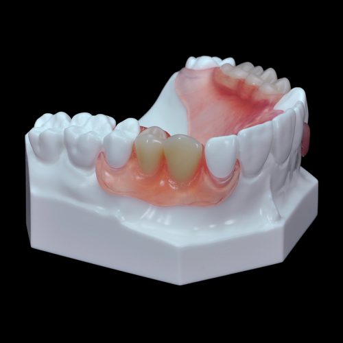 GD-07 Flexible Partial Upper Denture | Paradigm Dental Models