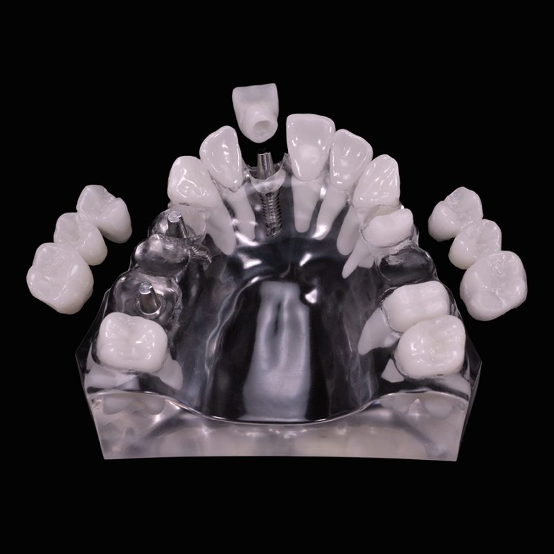 IM-08 Hader Bar | Paradigm Dental Models