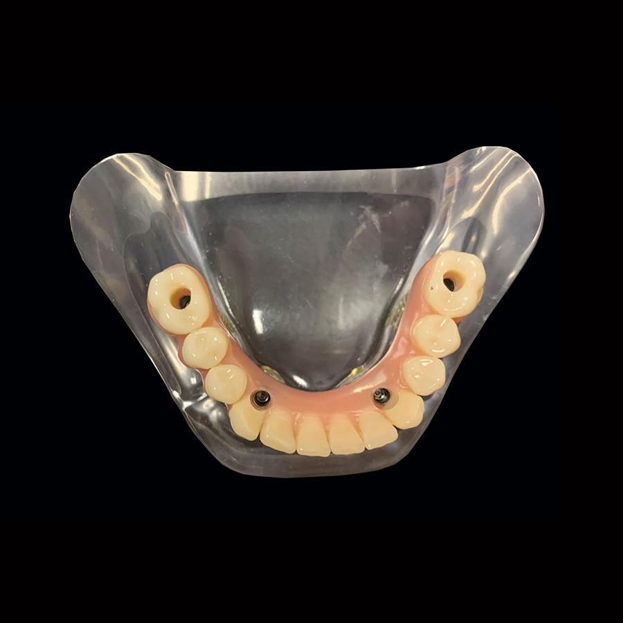 All On 4 B | Paradigm Dental Models