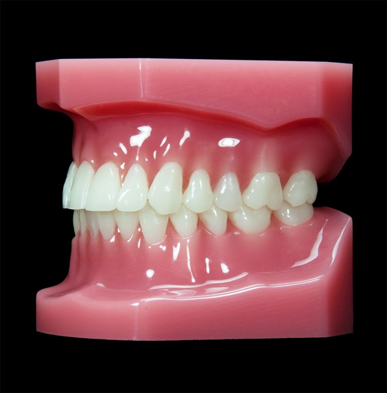 OR-02 Pink Ideal (Flexibase) | Paradigm Dental Models