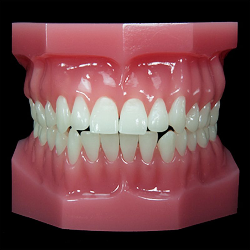 OR-13D Class II Div 1: Finishing | Paradigm Dental Models