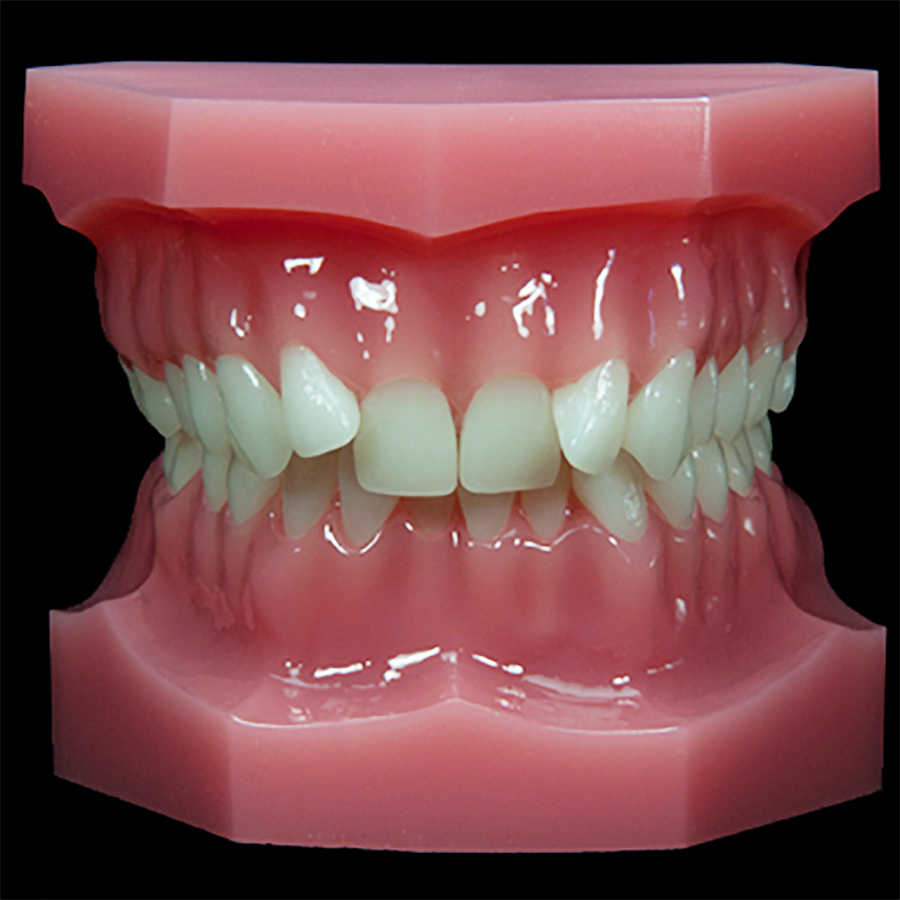 https://paradigmmodels.com/wp-content/uploads/Product-Images/Orthodontic/OR(11-20)/OR-15/OR-15A/OR-15A_F_N1-900x900_W.jpg