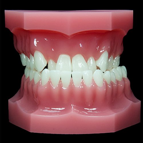 OR-16A Class III Surgical: Level and Align | Paradigm Dental Models