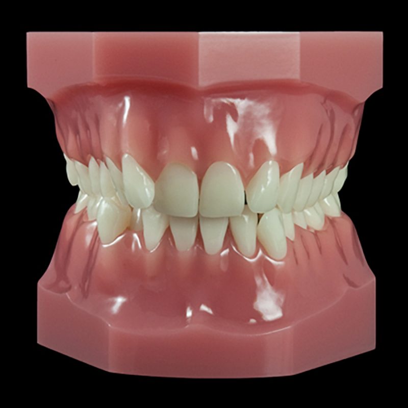 OR-17J Mixed Dentition Kit (FlexiBase) | Paradigm Dental Models