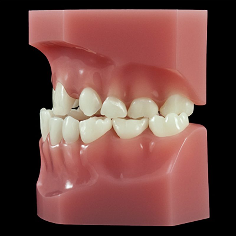 OR-17J Mixed Dentition Kit (FlexiBase) | Paradigm Dental Models