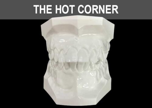 The Hot Corner